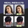 Untitled-design-19-1.png Toppik Hair Building Fibers Black 27.5g | Hair Concealer